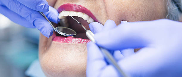 Best Emergency Wisdom Teeth Removal in Five Forks, SC